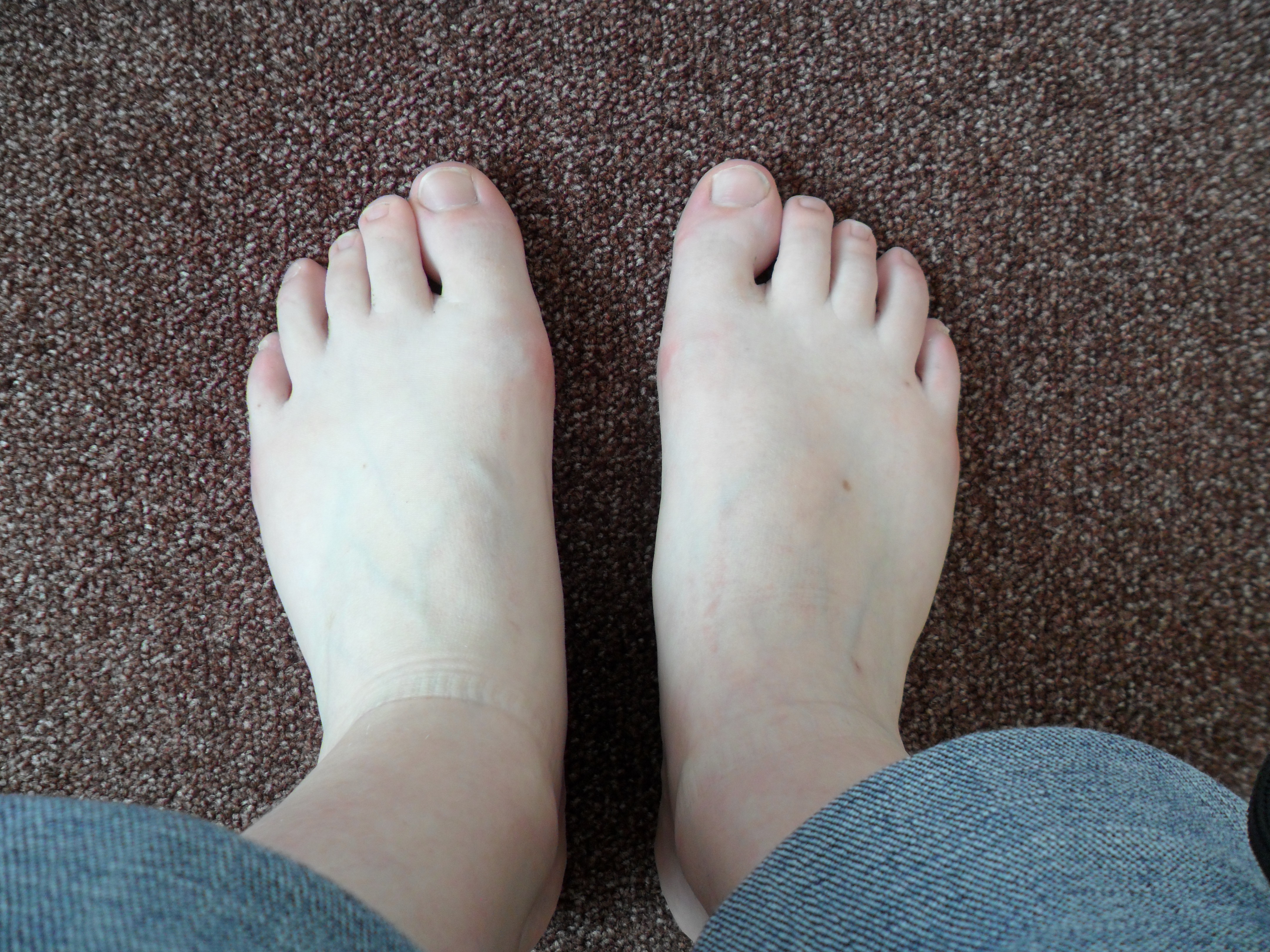 Large feet